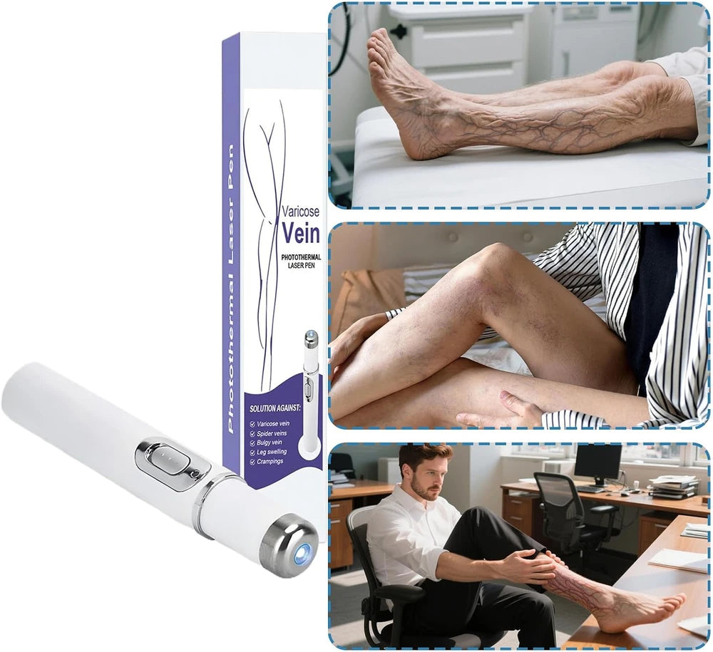 Portable Spider Vein Removal Pen