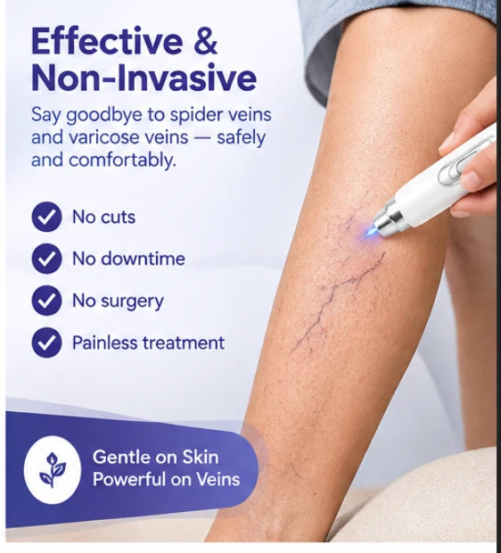 Portable Spider Vein Removal Pen